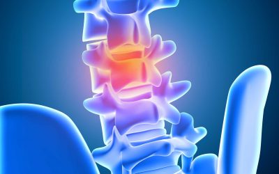 Bandscheibenvorfall: Mit Bewegung zurück zur Stärke