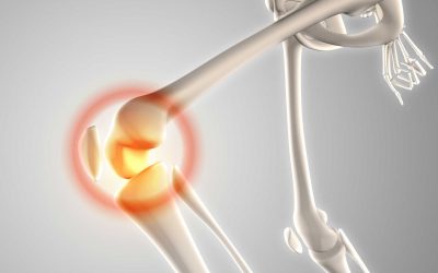 Osteoporose: Was Sie für starke Knochen tun können